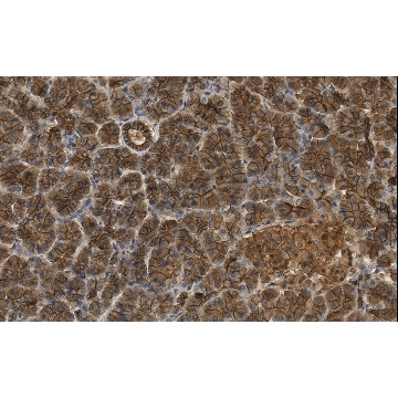 Anti-beta Catenin Antibody, clone 3J7, ZooMAb® Rabbit Monoclonal，25UL，ZRB05665-25UL，Sigma