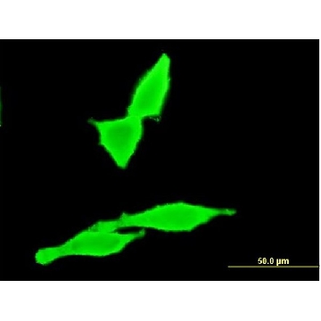 Monoclonal Anti-CNR2 antibody produced in mouse，100UG，WH0001269M1-100UG，Sigma