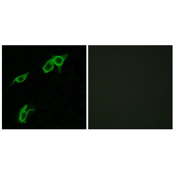 Anti-GPR75 antibody produced in rabbit，100UG，SAB4500182-100UG，Sigma