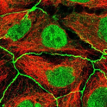 Anti-PDGFRA antibody produced in rabbit，100UL，HPA004947-100UL，Sigma