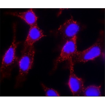 Anti-Cholera toxin, B Subunit (CTxB) antibody, Mouse monoclonal，100UL，SAB4200844-100UL，Sigma