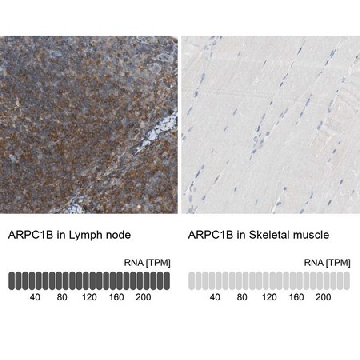 抗-ARPC1B 兔抗，100UL，HPA004832-100UL，Sigma