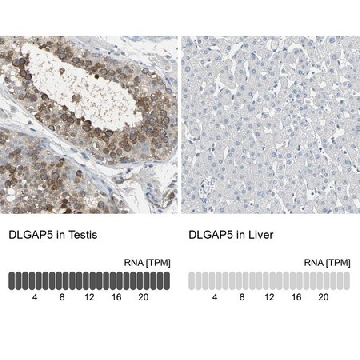 Anti-DLGAP5 antibody produced in rabbit，100UL，HPA005546-100UL，Sigma
