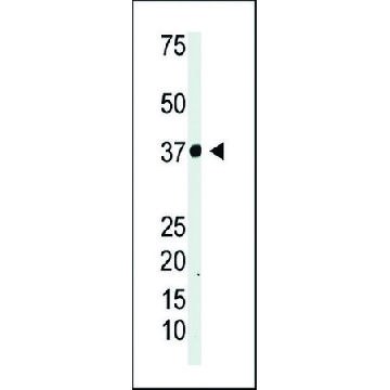 ANTI-IKB ALPHA (IKBA) antibody produced in rabbit，400UL，SAB1305978-400UL，Sigma