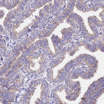 Anti-MRPL3 antibody produced in rabbit，100UL，HPA043665-100UL，Sigma