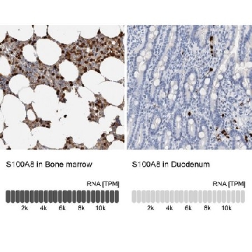 Anti-S100A8 antibody produced in rabbit，100UL，HPA024372-100UL，Sigma