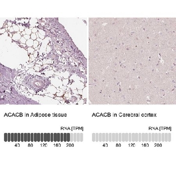 Anti-ACACB antibody produced in rabbit，100UL，HPA006554-100UL，Sigma