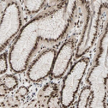 Anti-BLM antibody produced in rabbit，100UL，HPA005689-100UL，Sigma