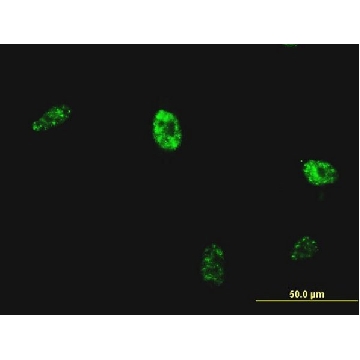 Monoclonal Anti-NKX2-5 antibody produced in mouse，100UG，SAB1408911-100UG，Sigma