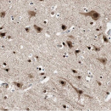 Anti-FBXO44 antibody produced in rabbit，100UL，HPA003363-100UL，Sigma
