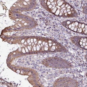 Anti-STRIP1 antibody produced in rabbit，100UL，HPA060302-100UL，Sigma