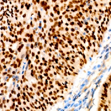 Anti-p63 Antibody, clone 3M9X7, Rabbit Monoclonal，100UL，SAB5702933-100UL，Sigma