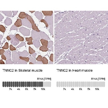 Anti-TNNC2 antibody produced in rabbit，100UL，HPA058481-100UL，Sigma