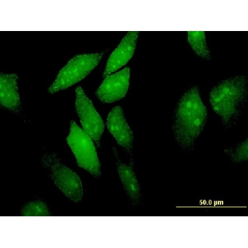 Monoclonal Anti-EIF4ENIF1, (C-terminal) antibody produced in mouse，100UG，SAB1402606-100UG，Sigma