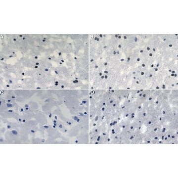Anti-Olig2 Antibody, clone 1K2 ZooMAb® Rabbit Monoclonal，4X25UL，ZRB1436-4X25UL，Sigma