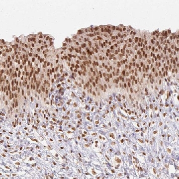 Anti-NFE2L1 antibody produced in rabbit，100UL，HPA065424-100UL，Sigma