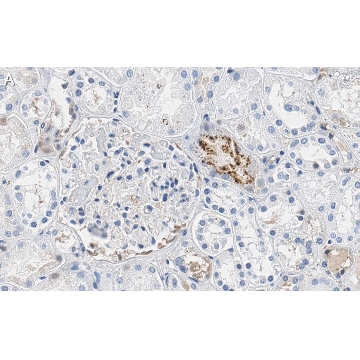 Anti-PEDF (SERPIN F1) Antibody, clone 2C16 ZooMAb® Rabbit Monoclonal，25UL，ZRB1501-25UL，Sigma