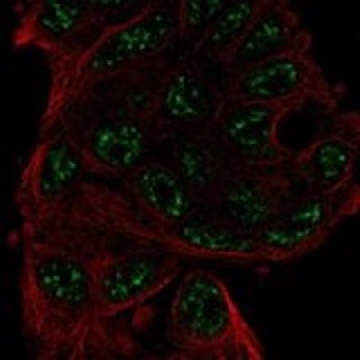 Anti-ANKRD55 antibody produced in rabbit，100UL，HPA061649-100UL，Sigma