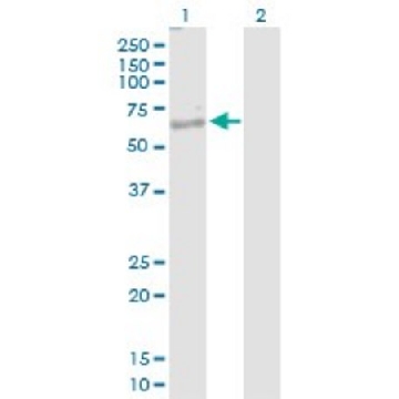 Anti-NKD1 antibody produced in rabbit，100UG，SAB1401923-100UG，Sigma