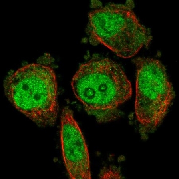 Anti-DUS3L antibody produced in rabbit，100UL，HPA062846-100UL，Sigma
