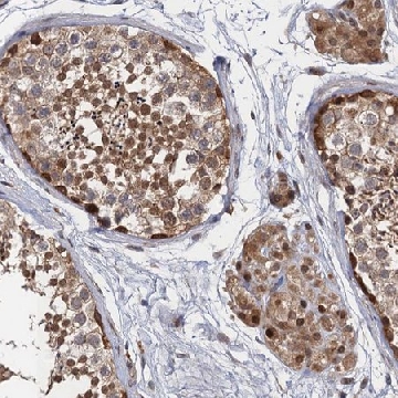 Anti-NEK8 antibody produced in rabbit，100UL，HPA040661-100UL，Sigma
