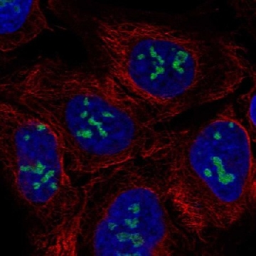 Anti-RIOX1 antibody produced in rabbit，100UL，HPA003730-100UL，Sigma
