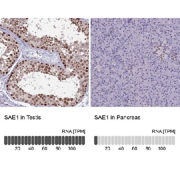 Anti-SAE1 antibody produced in rabbit，100UL，HPA043552-100UL，Sigma