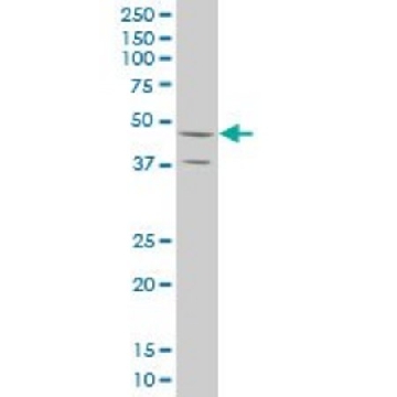 ANTI-STYK1 antibody produced in mouse，100UG，SAB1412630-100UG，Sigma