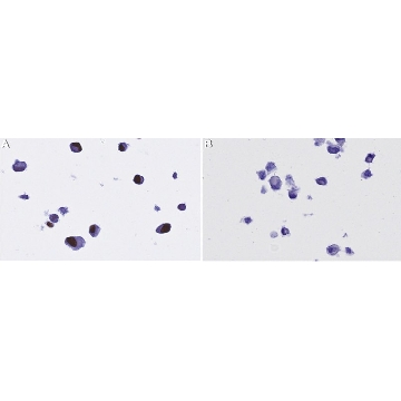 Anti-CMV immediate early Antibody, clone 6F8.2 ZooMAb® Mouse Monoclonal，254G，ZMS1121-25UL，Sigma