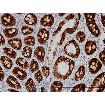 Monoclonal Anti-CDH17 antibody produced in mouse，100UG，WH0001015M1-100UG，Sigma