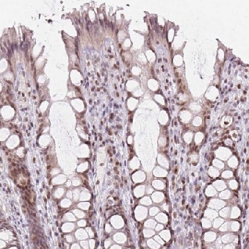 Anti-KAT6A antibody produced in rabbit，100UL，HPA063266-100UL，Sigma