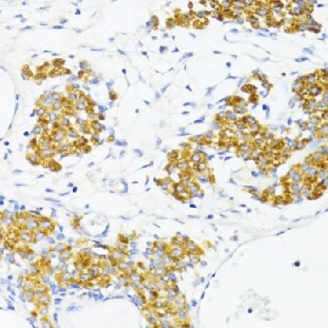 Anti-Fibronectin antibody produced in rabbit，100UL，SAB5700724-100UL，Sigma