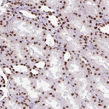 Anti-TMEM184C antibody produced in rabbit，100UL，HPA054013-100UL，Sigma