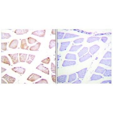 Anti-AKT antibody produced in rabbit，100UG，SAB4500800-100UG，Sigma