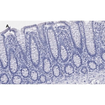 Anti-BRG1 Antibody, clone 1N12, ZooMAb® Rabbit Monoclonal，25UL，ZRB1148-25UL，Sigma