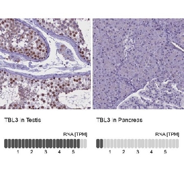 Anti-TBL3 antibody produced in rabbit，100UL，HPA042562-100UL，Sigma