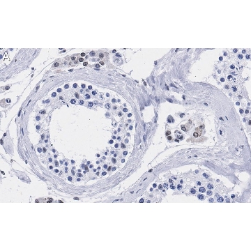 Anti-TFE3 Antibody, clone 1G5 ZooMAb® Rabbit Monoclonal，4X25UL，ZRB1272-4X25UL，Sigma