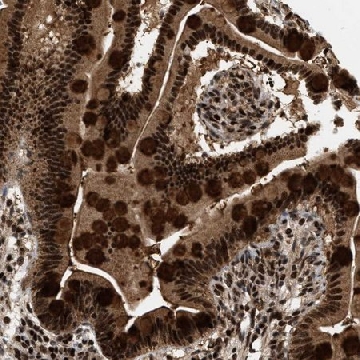 Anti-RBM5 antibody produced in rabbit，100UL，HPA018011-100UL，Sigma