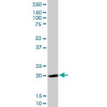Anti-FTH1 antibody produced in rabbit，100UG，SAB1410457-100UG，Sigma
