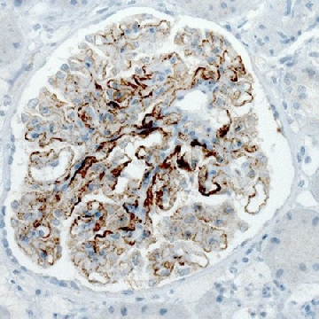 单克隆抗-PLA2R1 小鼠抗，100UL，AMAB90775-100UL，Sigma