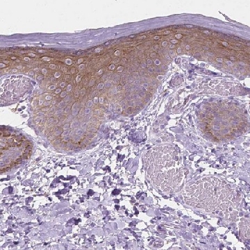 Anti-EPPK1 antibody produced in rabbit，100UL，HPA069333-100UL，Sigma