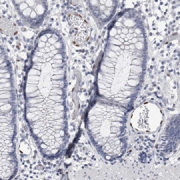 Anti-IL33 antibody produced in rabbit，100UL，HPA024426-100UL，Sigma