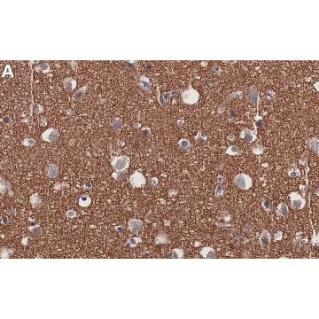 Anti-Tau Antibody, clone Tau-5 ZooMAb® Mouse Monoclonal，4X25UL，ZMS1111-4X25UL，Sigma