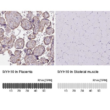 Anti-MYH10 antibody produced in rabbit，100UL，HPA047541-100UL，Sigma