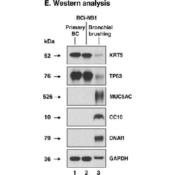 Anti-DNAI1 antibody produced in rabbit，100UL，HPA021649-100UL，Sigma