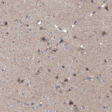 Anti-EOMES antibody produced in rabbit，100UL，HPA028896-100UL，Sigma