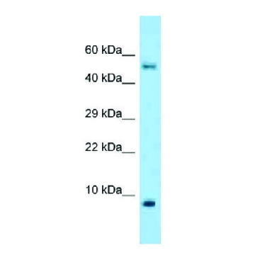 Anti-S100A10 antibody produced in rabbit，100UL，SAB2109163-100UL，Sigma