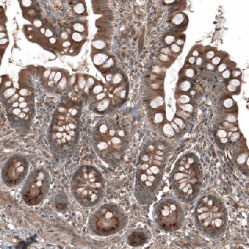 Anti-HMGCR antibody produced in rabbit，100UL，HPA008338-100UL，Sigma