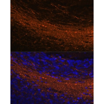 Anti-CNPase Antibody, clone 8O3B6, Rabbit Monoclonal，100UL，SAB5702133-100UL，Sigma