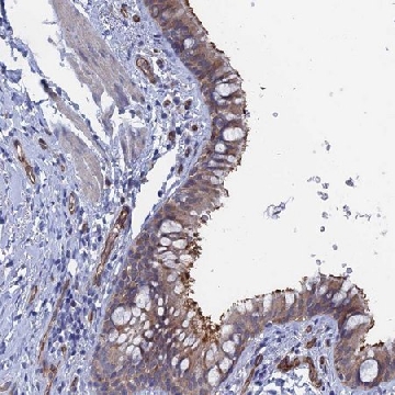 Anti-ARAP3 antibody produced in rabbit，100UL，HPA042887-100UL，Sigma